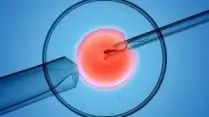 Best IVF Center in Patna with our doctor expertise and success rate