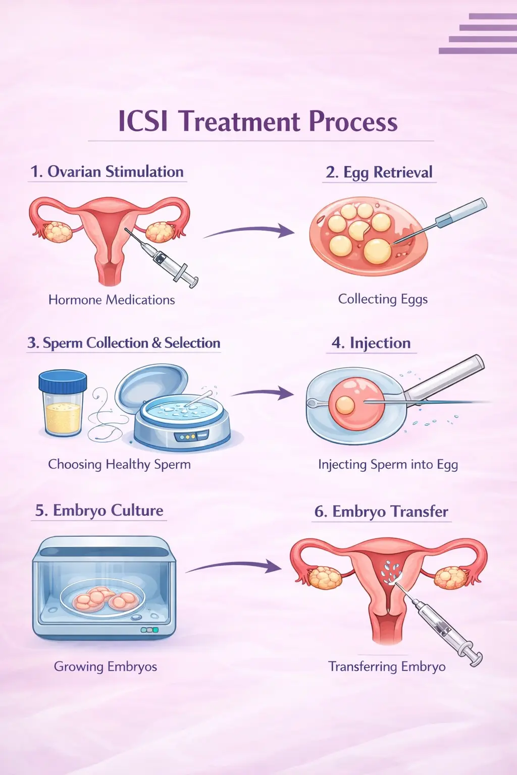 ICSI Treatment Process