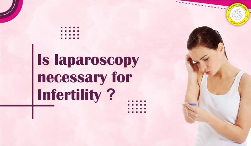 Jun 22 2022 Is laparoscopy necessary for Infertility