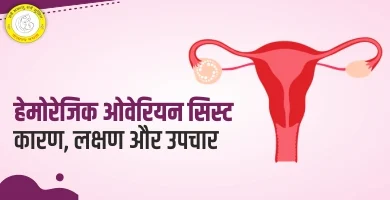 Hemorrhagic Cyst in Hindi हेमोरेजिक सिस्ट क्या है लक्षण और इलाज