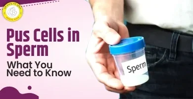 Pus Cells in Sperm: Causes, Normal Range & Effective Treatments