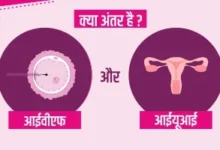IVF vs IUI in Patna