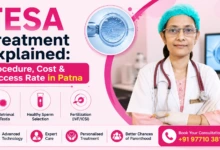TESA Treatment Explained Procedure, Cost & Success Rate in Patna
